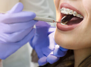 orthodontic _tooth_extraction_01